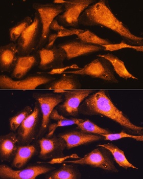 PFKP Antibody, KO Validated
