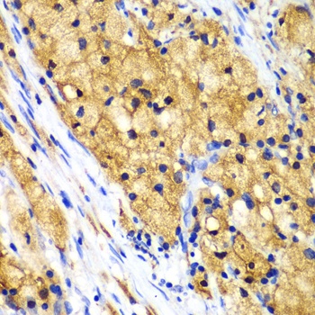 CAPG Antibody, KO Validated