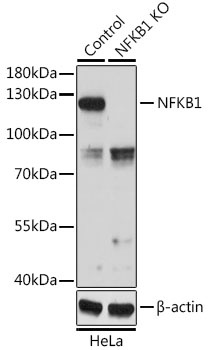 NFKB1 Antibody, KO Validated