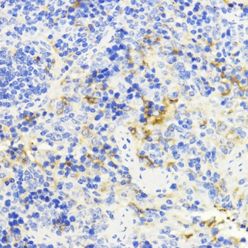 NFKB1 Antibody, KO Validated