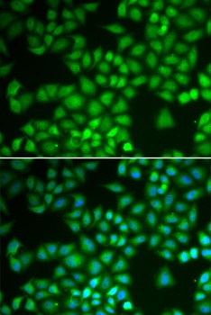 NFKB1 Antibody, KO Validated
