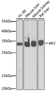 AK2 Antibody, KO Validated