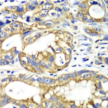 AK2 Antibody, KO Validated
