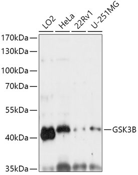 GSK3B Antibody, KO Validated