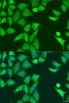 Eif2ak2 Antibody, KO Validated