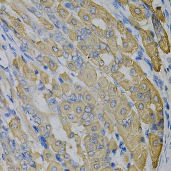 GLUL Antibody, KO Validated