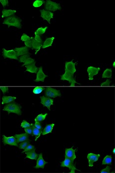 GLUL Antibody, KO Validated
