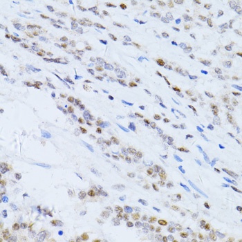 P21 Antibody, KO Validated