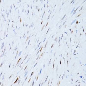 P21 Antibody, KO Validated