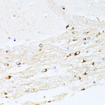 P21 Antibody, KO Validated
