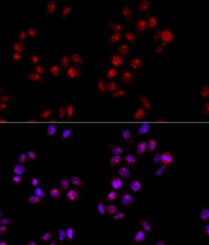 HMGB1 Antibody, KO Validated