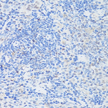Caspase 3 Antibody, KO Validated