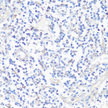 Caspase 3 Antibody, KO Validated