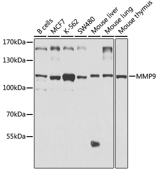 MMP9 Antibody, KO Validated