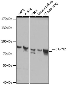 CAPN2 Antibody, KO Validated