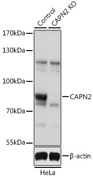 CAPN2 Antibody, KO Validated