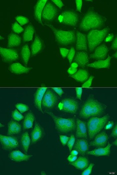 CAPN2 Antibody, KO Validated