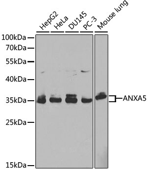ANXA5 Antibody, KO Validated