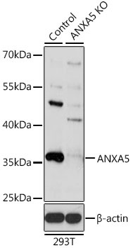 ANXA5 Antibody, KO Validated
