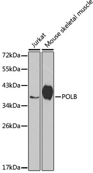 POLB Antibody, KO Validated