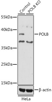 POLB Antibody, KO Validated