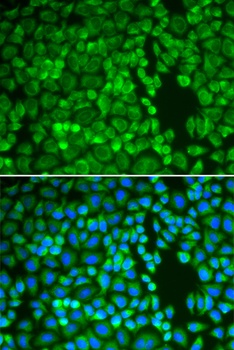 IDE Antibody, KO Validated