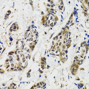 MAPK9 Antibody, KO Validated