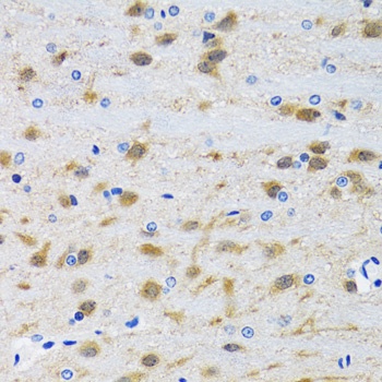 MAPK9 Antibody, KO Validated