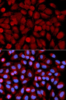 MAPK9 Antibody, KO Validated