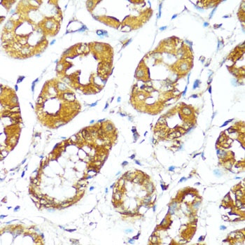 BAX Antibody, KO Validated