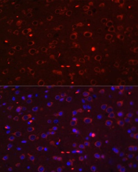 STAT3 Antibody, KO Validated