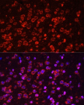 STAT3 Antibody, KO Validated