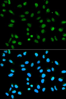 HNRNPA2B1 Antibody, KO Validated