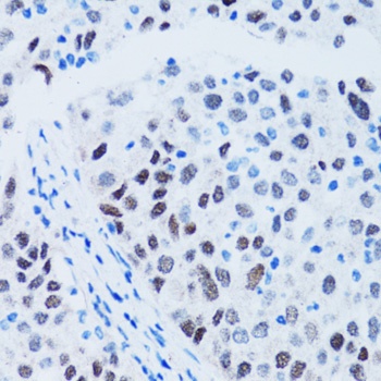 p53 Antibody, KO Validated