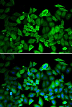 ANXA1 Antibody, KO Validated