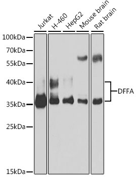 DFFA Antibody, KO Validated