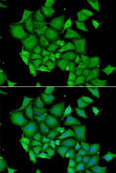 DFFA Antibody, KO Validated