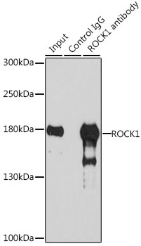 ROCK1 Antibody, KO Validated
