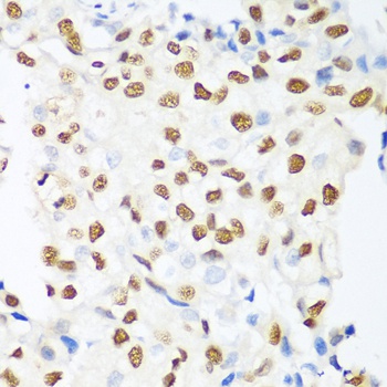HDAC1 Antibody, KO Validated