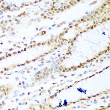 HDAC1 Antibody, KO Validated