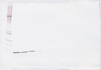 TGF-beta 3 Antibody