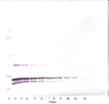 TNF-beta Antibody (biotin)