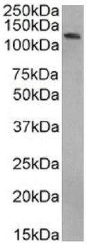 BRD4 Antibody [RAB-C131], Rabbit IgG