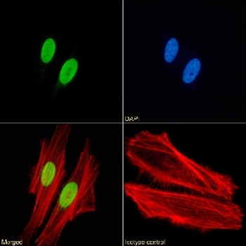 H4 K8Ac; K12Ac; K16Ac Antibody [KM-2], Rabbit IgG