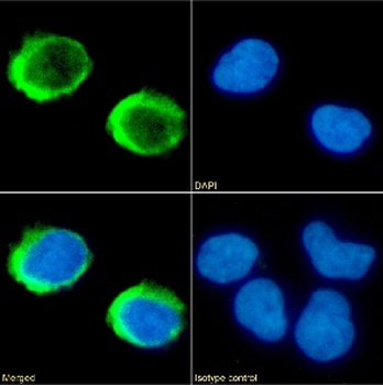 CD154 Antibody [IDEC-131 (Toralizumab)], Rabbit IgG - Research Grade Biosimilar