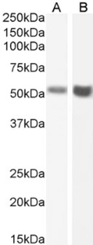 Fas Antibody [R-125224], Rabbit IgG