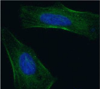 EGFR domain III Antibody [h-R3 (Nimotuzumab)], Rabbit IgG - Research Grade Biosimilar