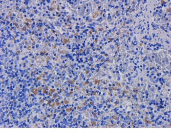 CD11a Antibody [hu1124 (Efalizumab)], Human IgG1 - Research Grade Biosimilar
