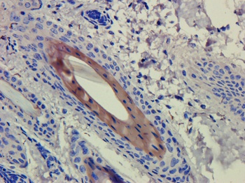 CD4 Antibody [CE9.1 (Clenoliximab)], Human IgG4 - Research Grade Biosimilar