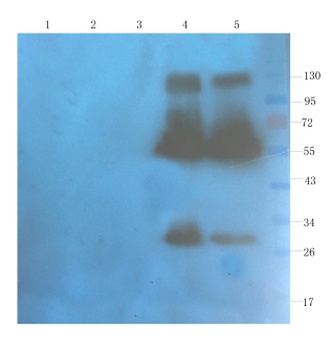 CD40L Antibody [hu5c8 (Ruplizumab)], Human IgG1 - Research Grade Biosimilar